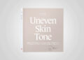 filabe uneaven skin tone - FACES.ch
