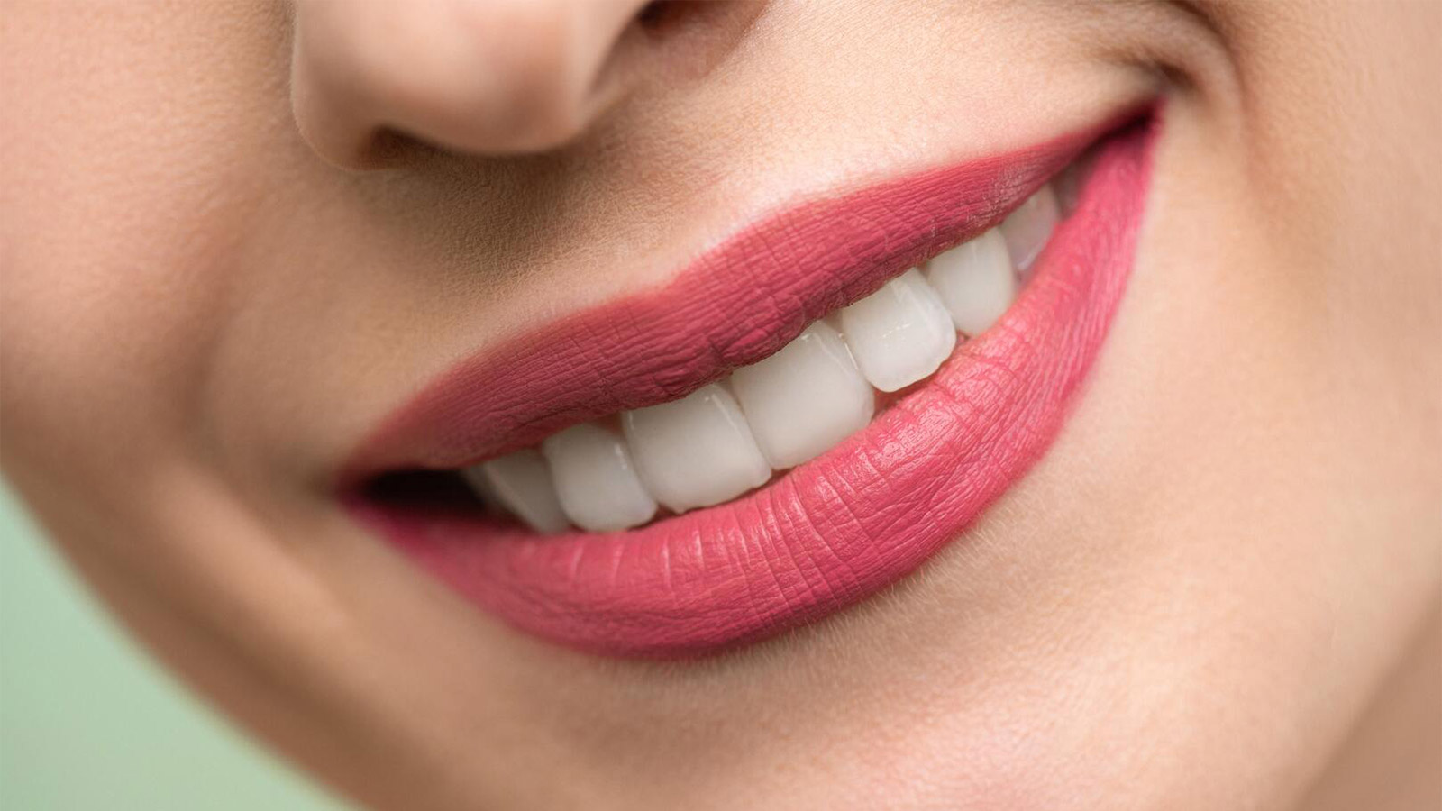 Mit Zahnästhetik zum Hollywood-Lächeln: Möglichkeiten der modernen Dentalmedizin Teaser